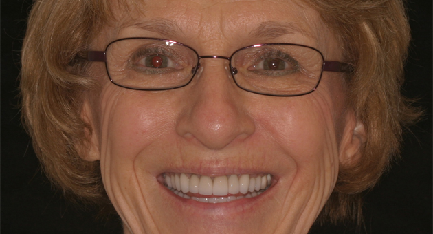 Really Smile Really Smile