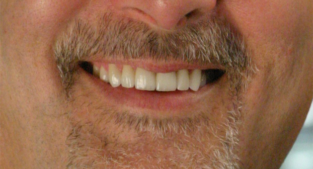 Really Smile Really Smile
