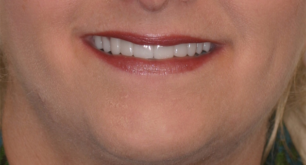 Really Smile Really Smile