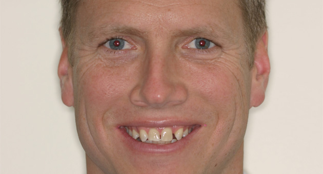 Really Smile Really Smile