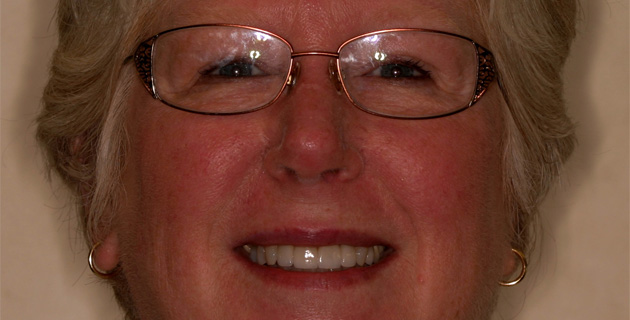 Really Smile Really Smile