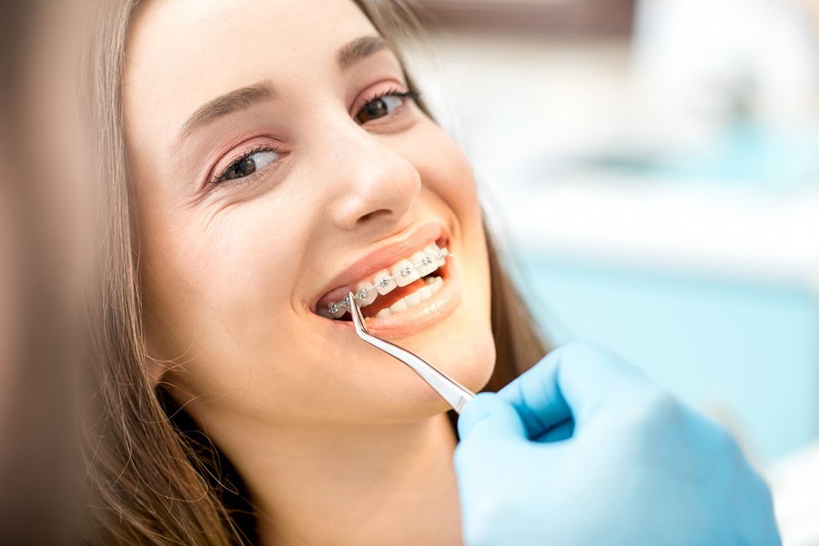 Fast Braces Solutions for Adults