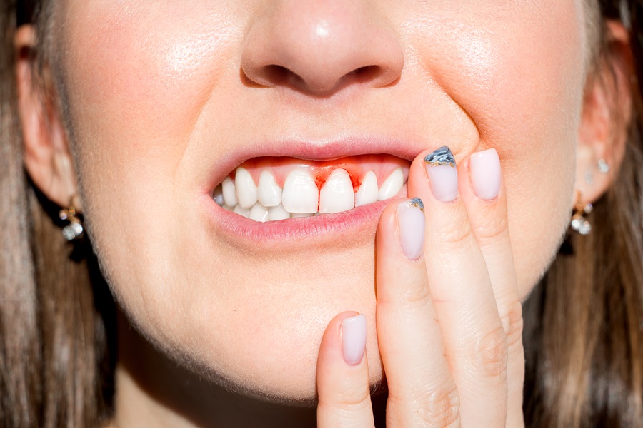 Things You Can Do to Prevent Gum Disease