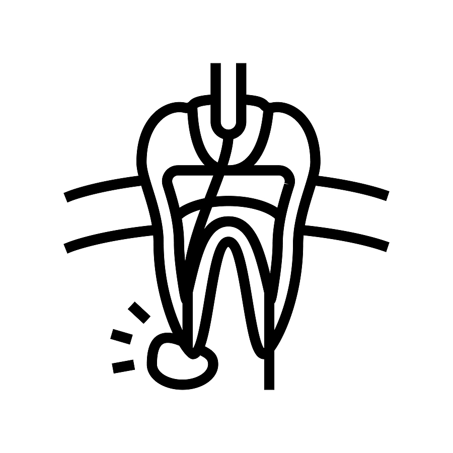 Overcoming Root Canal Fear Pt. 2