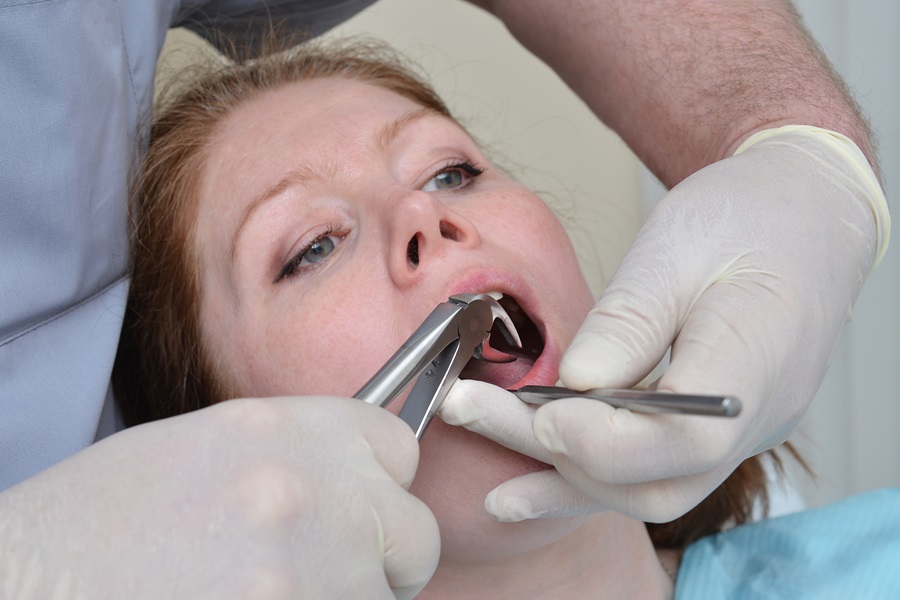 5 Need-To-Know Facts About Root Canals