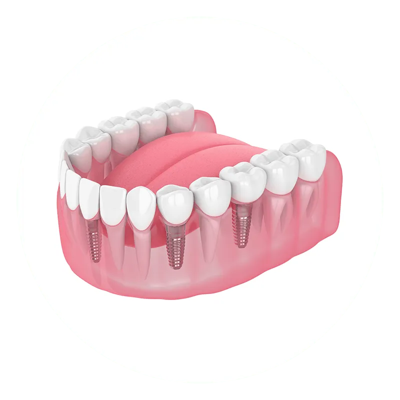 Multiple Missing Teeth Multiple Missing Teeth